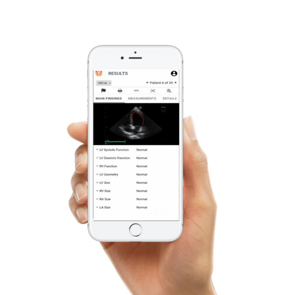 Us2.ai - logiciel d'IA en échocardiographie